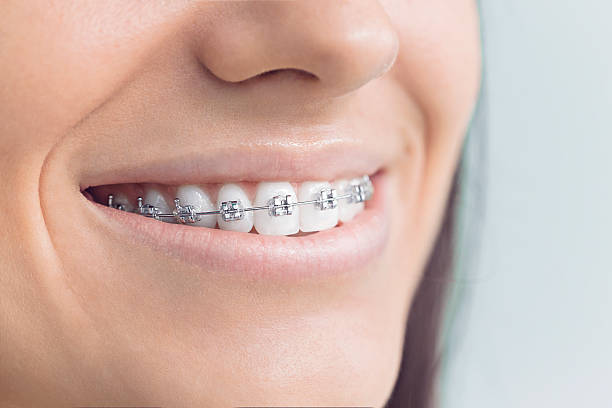Dental Inlays and Onlays in Preakness, NJ